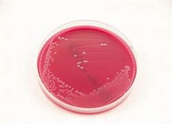 Image result for columbia_agar