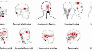 Image result for Four-Year Strong Brain Pain