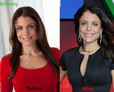 Image result for Bethenny Before and After