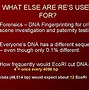 Image result for What Is a DNA Palindrome