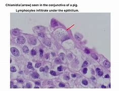 Image result for Chlamydia Microscopy