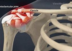 Image result for ACL Shoulder Injury