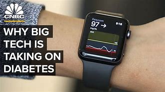 Image result for Smart Watch for Diabetics