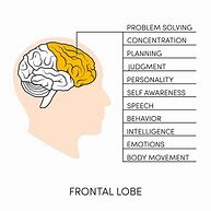 Image result for Frontal Lobe Brain Damage Symptoms
