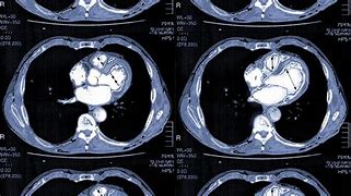 Image result for Cardiac CT Scan