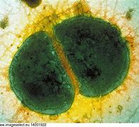 Image result for Neisseria Gonorrhoeae