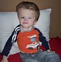 Image result for Babies Born with Hydrocephalus