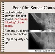 Image result for Lanex Screen Radiography