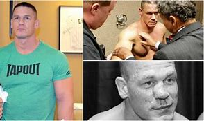 Image result for John Cena Injury