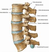 Image result for Axial T2 MRI Lumbar Spine