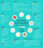 Image result for Types of Pregnancy Discharge
