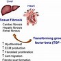 Image result for Lung Tumor Liver Heart