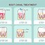Image result for Root Canal Cartoon