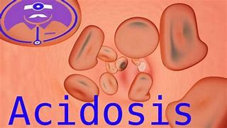 Image result for acidoxis