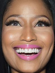 Image result for Nicki Minaj Teeth