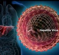 Image result for Liver Cancer Hepatitis B and C