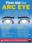 Image result for Arc Eye Welding