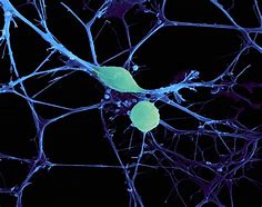 Image result for Neuron Microscope Image