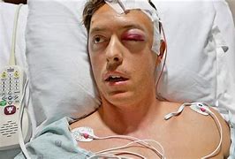 Image result for Brain Surgery Recovery