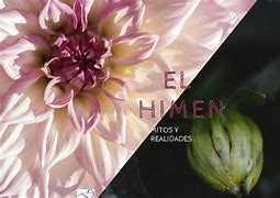 Image result for himenso