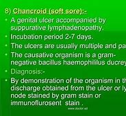 Image result for Genital Ulcer