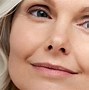 Image result for Cataract Plus Refractive Surgery