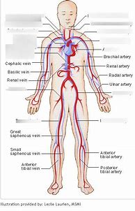 Image result for The Type MI and the Artery Supply