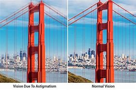 Image result for Astigmatism Blurry Vision