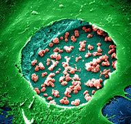 Image result for What Does Chlamydia Look Like