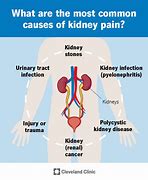 Image result for Sharp Kidney Pain