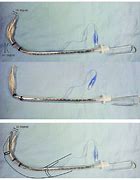 Image result for Endotracheal Tube with Stylet