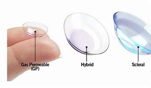 Image result for Keratoconus Contact Lenses