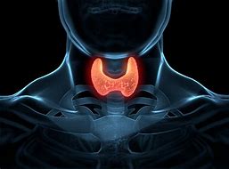 Image result for Types of Thyroid