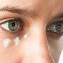 Image result for Red Swollen Itchy Eyes
