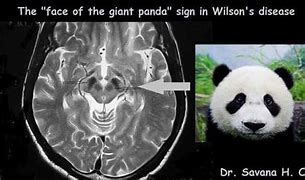 Image result for Double Panda Sign
