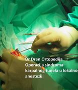 Image result for Operacija Ruke