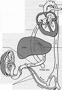 Image result for Umbilical Cord Healing Process