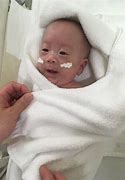 Image result for World's Smallest Baby