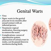 Image result for Genital Diseases