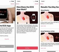 Image result for Apple Watch ECG Readings