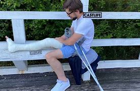 Image result for His Leg Cast