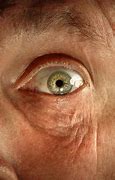 Image result for Elderly Eyes