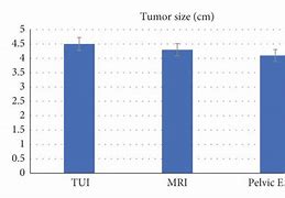 Image result for 11 Cm Tumor