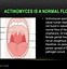 Image result for actonomices