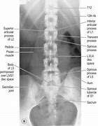 Image result for AP Lumbar Spine Anatomy