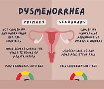 Image result for Dysmenorrhea