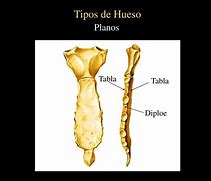 Image result for Diploe Huesos Planos
