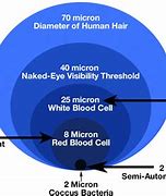 Image result for How Big Is 30 Microns