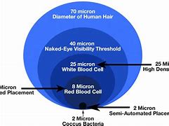 Image result for How IG Is 1 Micron