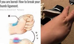 Image result for Thumb Ligament Meme